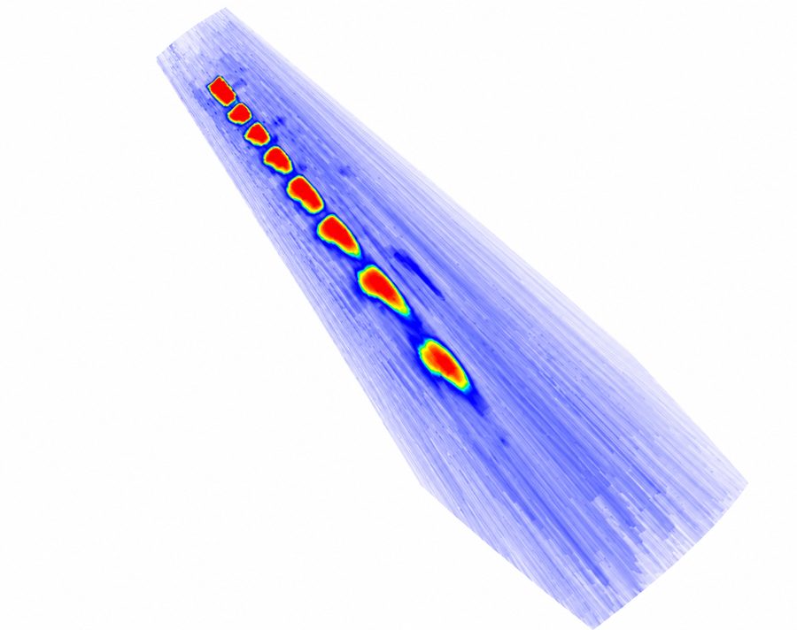 Imagen ultrasónica B-scan